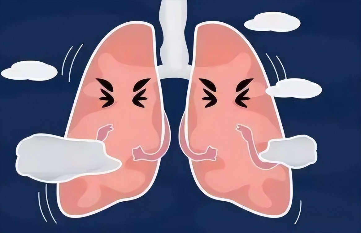 冬春咳黄痰是什么原因,黄痰是白肺征兆吗