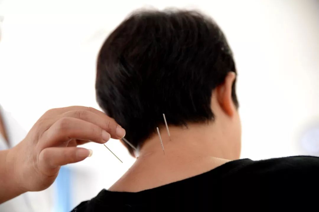 中医针灸治疗腰痛病的学术思想,古法针灸临床治验