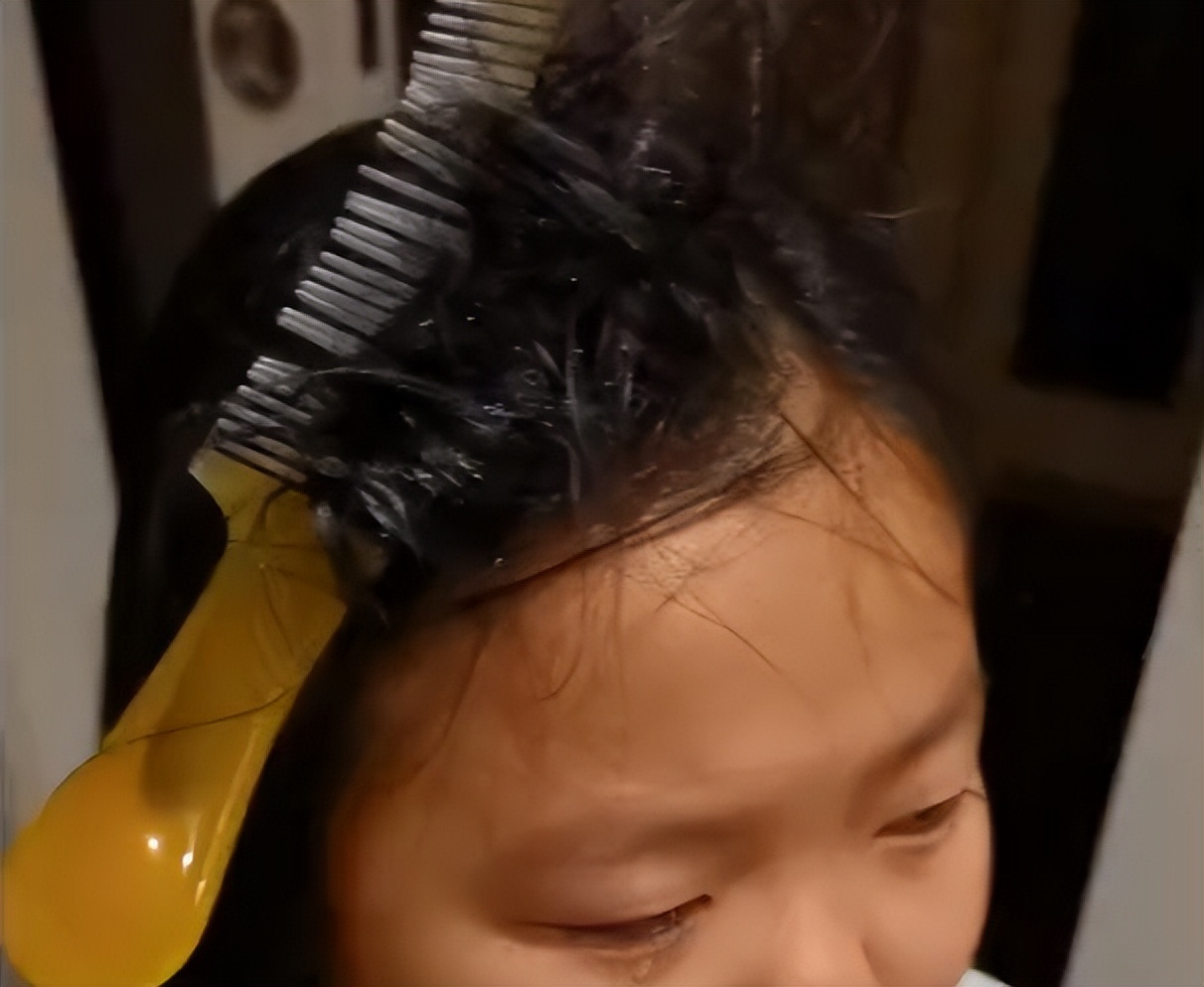 北京女孩头发被梳子卡住,女孩子头被梳子卡住