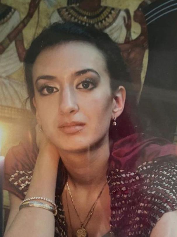 这个动手术打造世界最高颧骨的女人，再次向自己的颧骨下手了