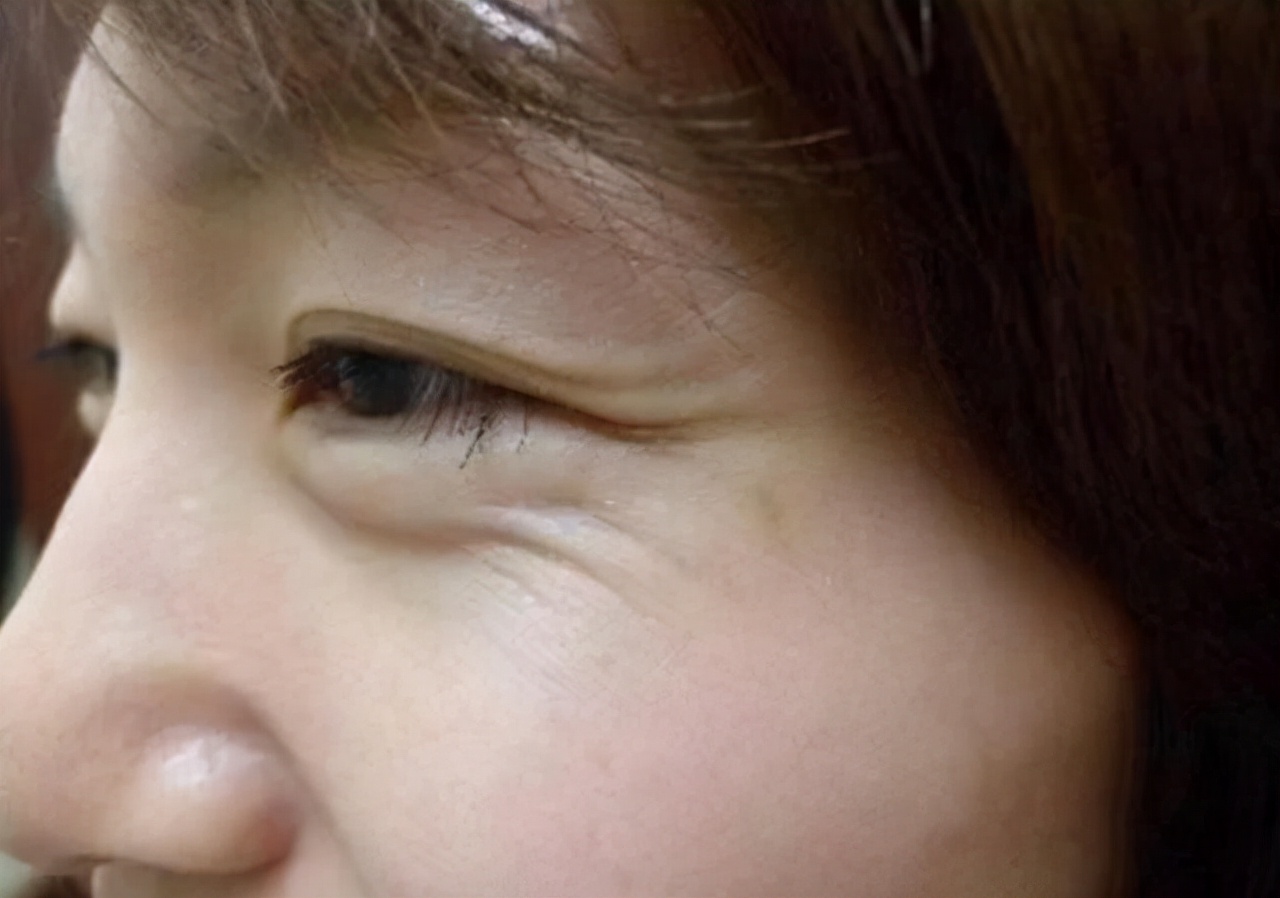 五官显老的女人怎么变年轻,什么样的女人容易显老