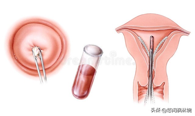 孕期各种困扰专家帮你解决,孕期各种困扰解决方案