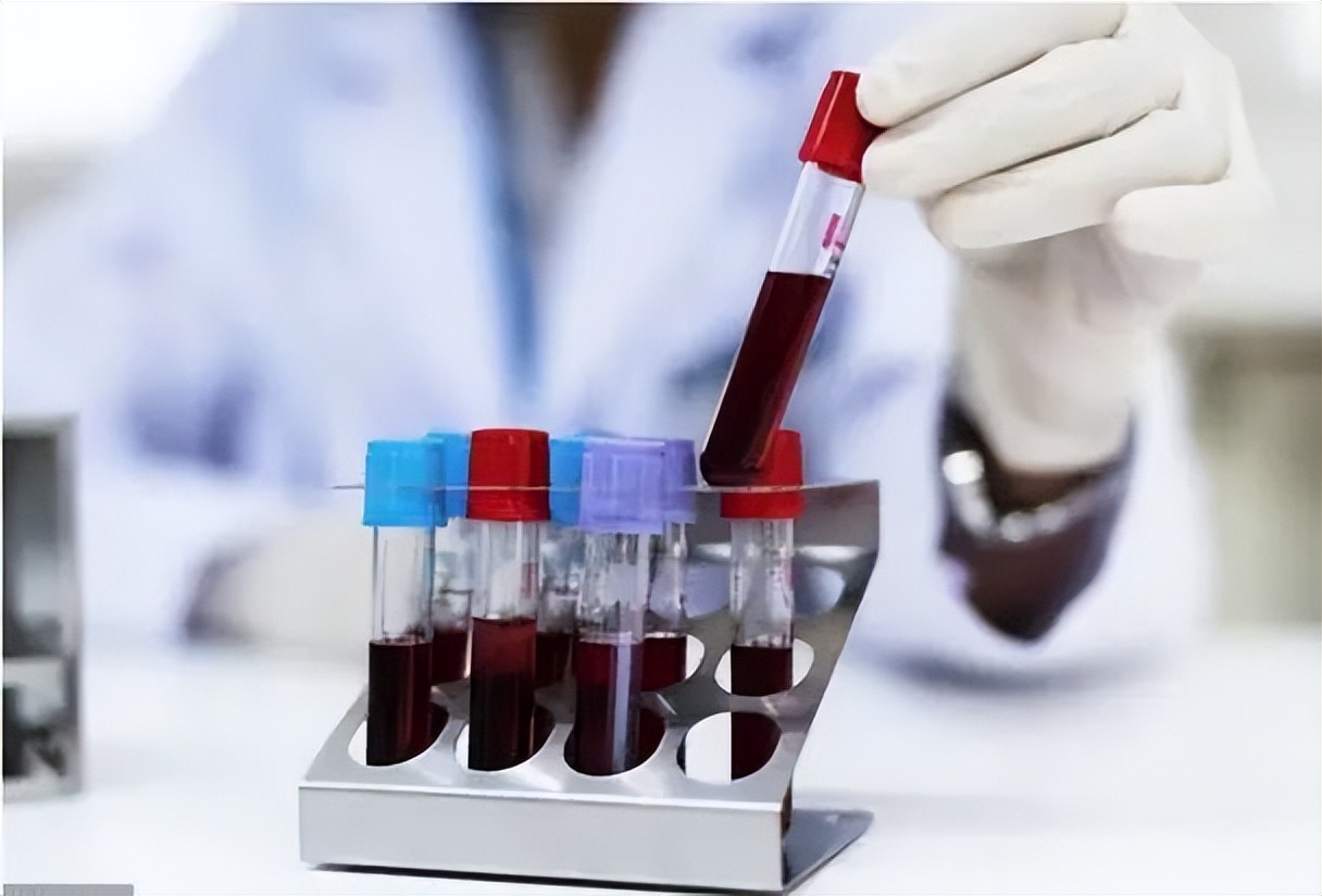 肝弹值高于多少就需要治疗?