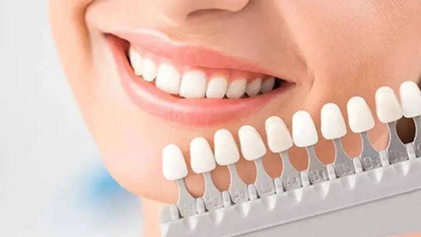 牙齿美白真相大揭秘,牙齿黄怎么美白