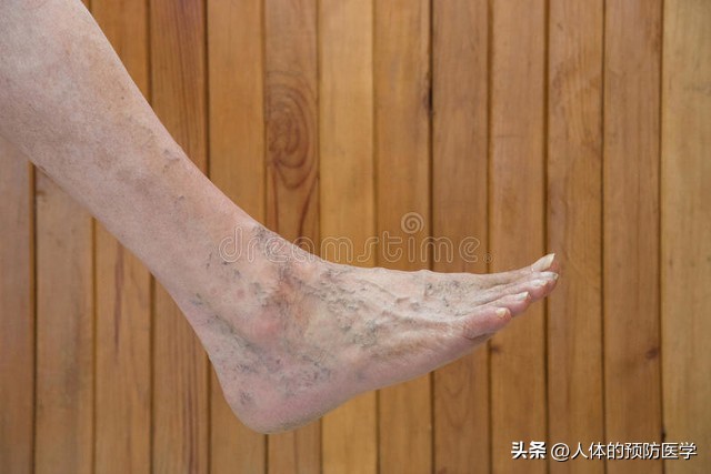 小腿脱皮是缺少什么营养,小腿脱皮像鱼鳞是缺维生素吗