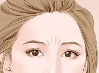 川字纹怎么去除最彻底淡纹,川字纹细纹怎么去除