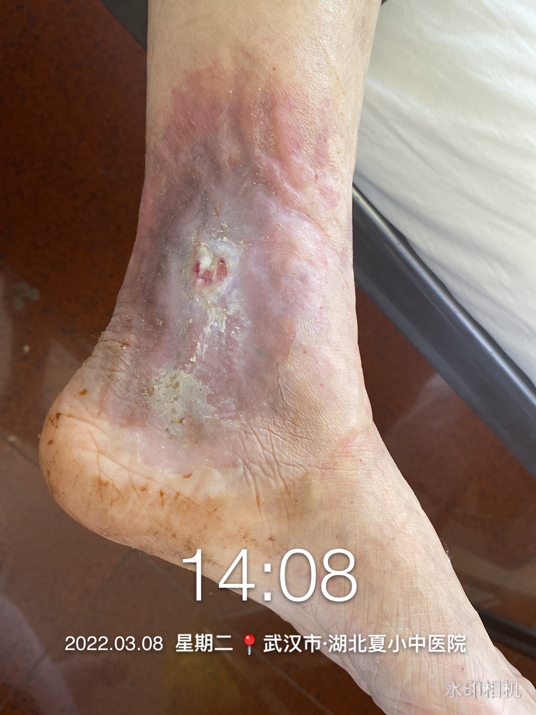 打赢持久战,打赢歼灭战打好持久战