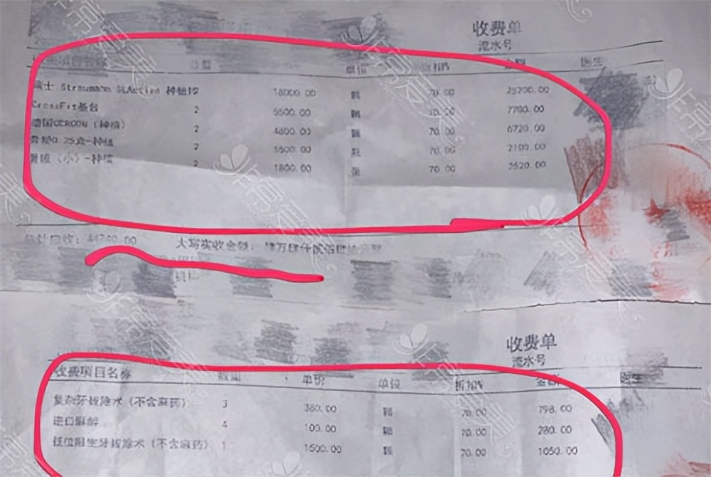 种植牙一颗多少元大概,种植牙究竟多少钱一颗
