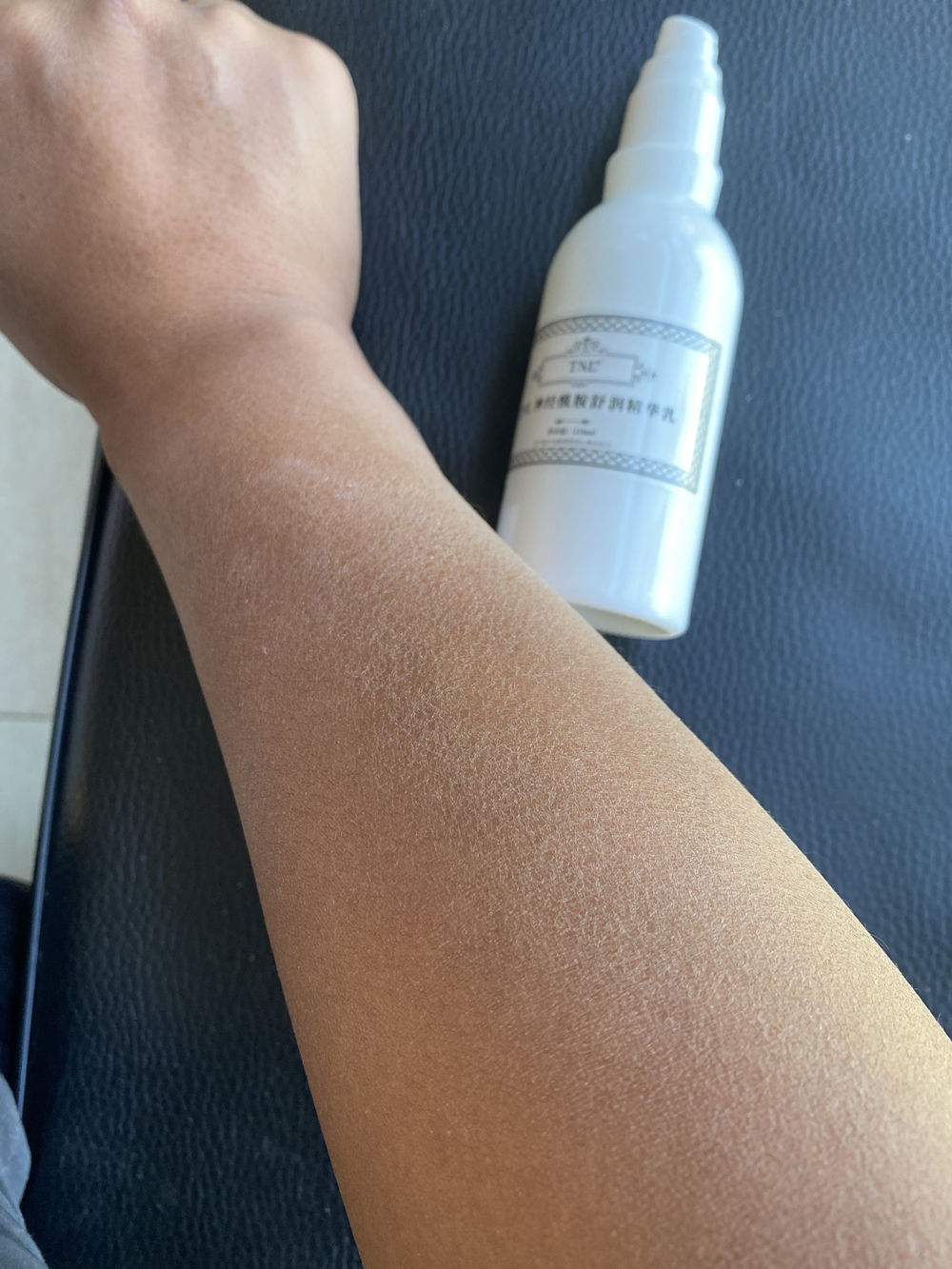 洗完澡身上痒还起皮是怎么回事,洗完澡皮肤干燥起皮浑身痒