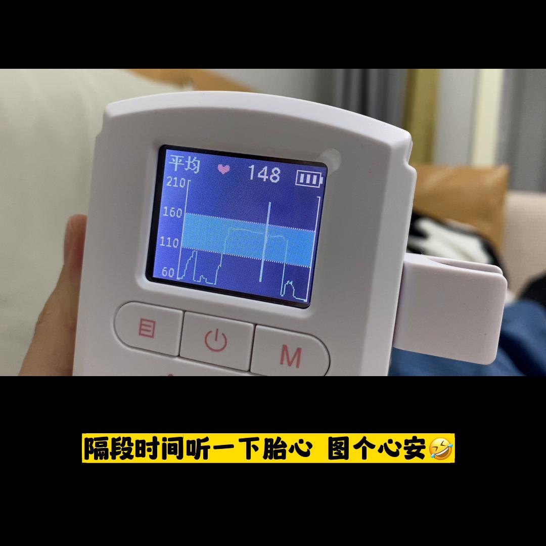 攒了十个月肉肉，兑换了一个天使宝宝👶🏻知道妈妈要提前...