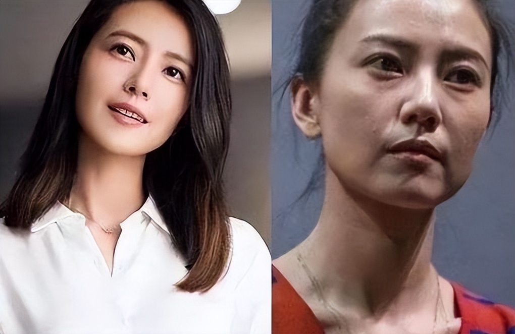 整容和不整容十年后的区别,整容与不整容的区别