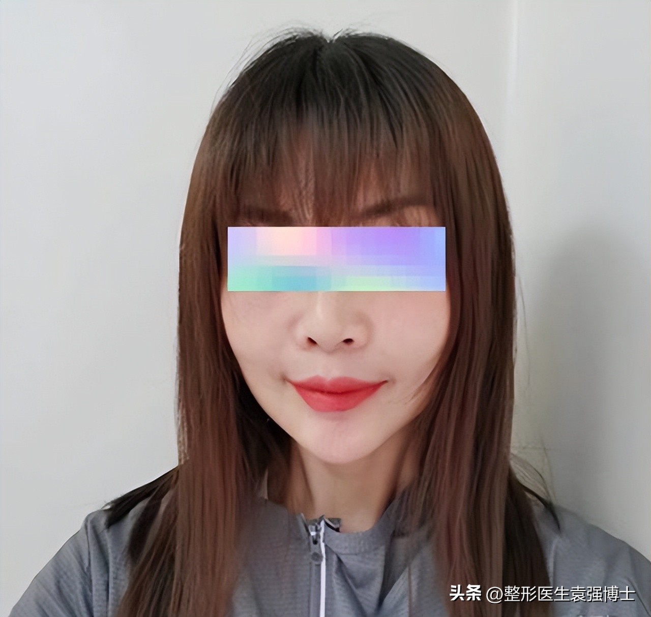 做拉皮手术会越来越薄吗,拉皮手术危险有真相