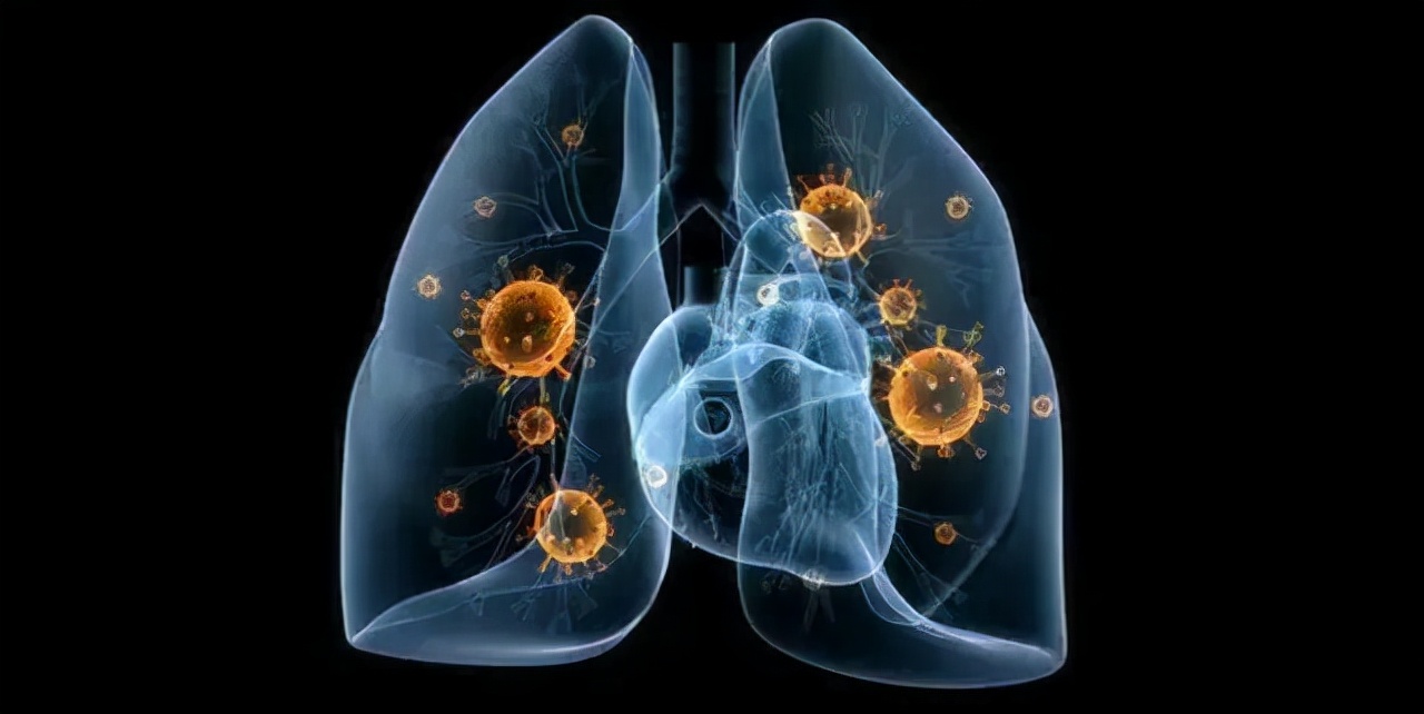 小细胞肺癌一线二线什么意思,小细胞肺癌二线治疗效果