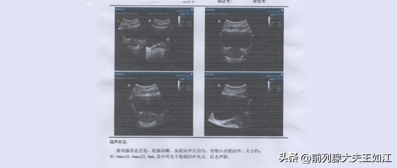 35岁小腹坠胀痛，他的前列腺炎治疗案例