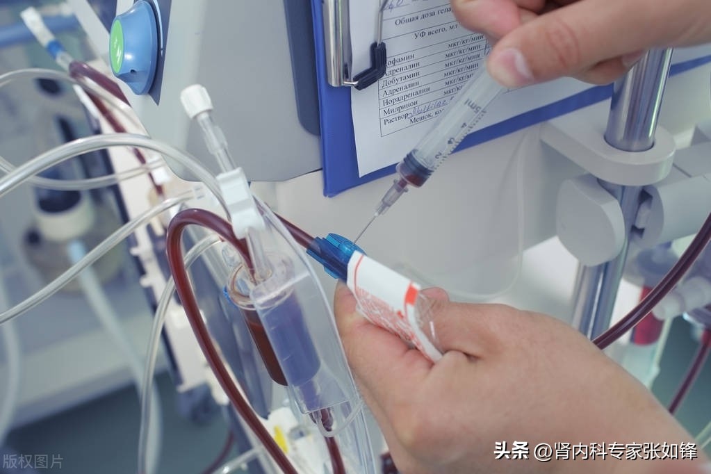 透析患者内瘘堵塞视频,临时管堵塞内瘘又没成熟怎么透析