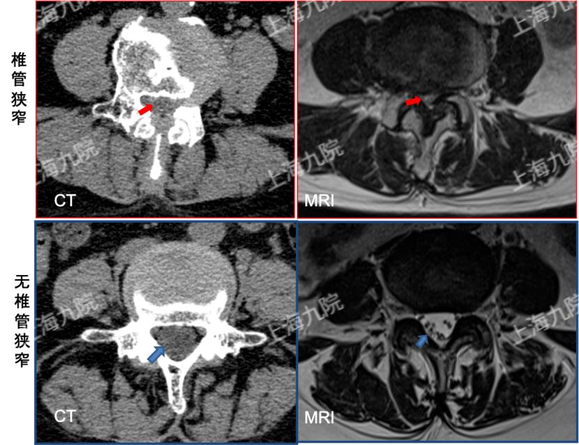 腰痛一直治不好要看神经科吗,经常腰痛要警惕四种原因