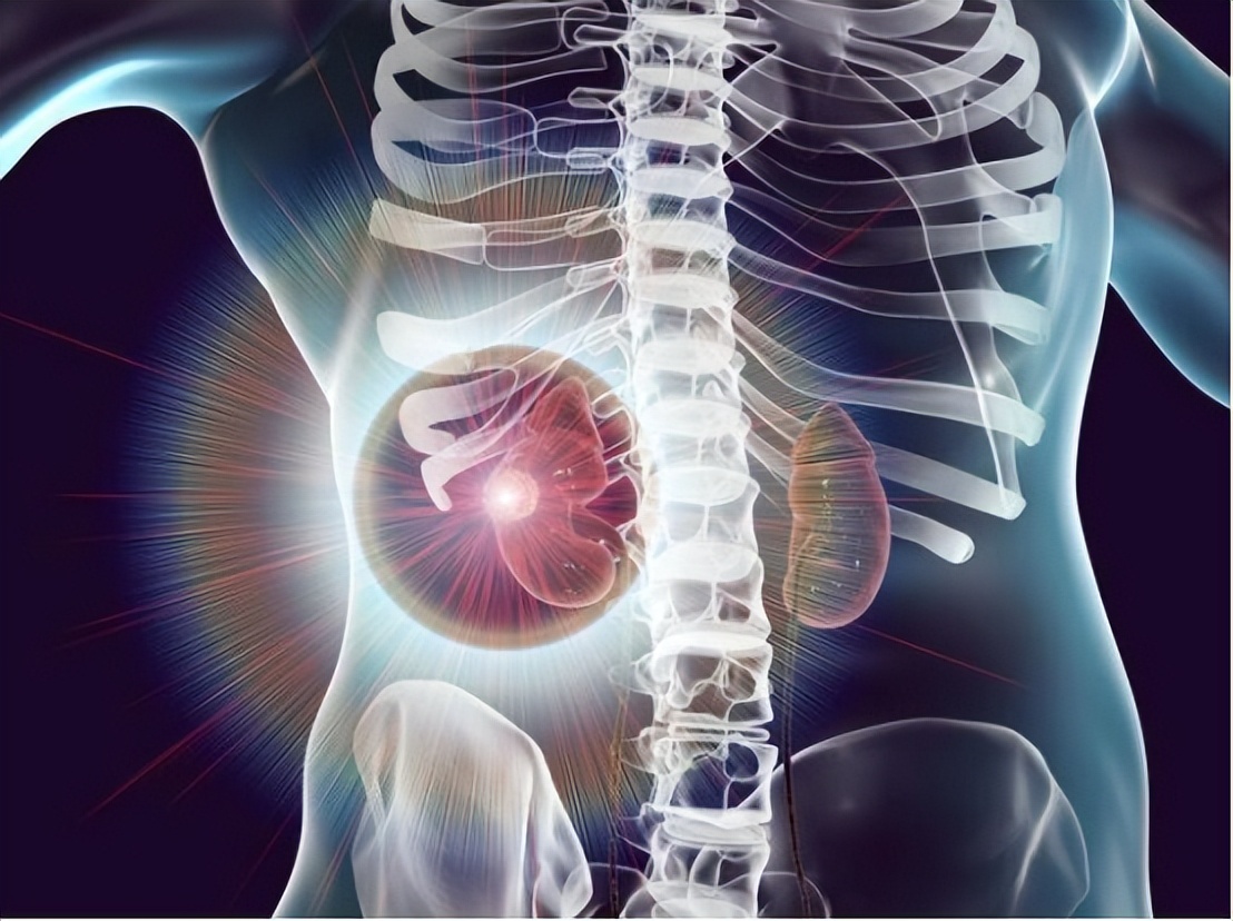 肾癌最好的手术方式,肾癌术后减轻的体重会恢复吗