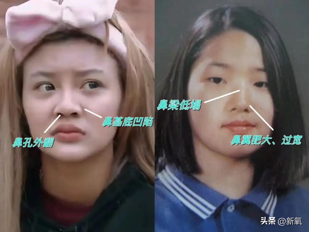 改一点赢很大？她整完鼻子直接美成断代神颜…