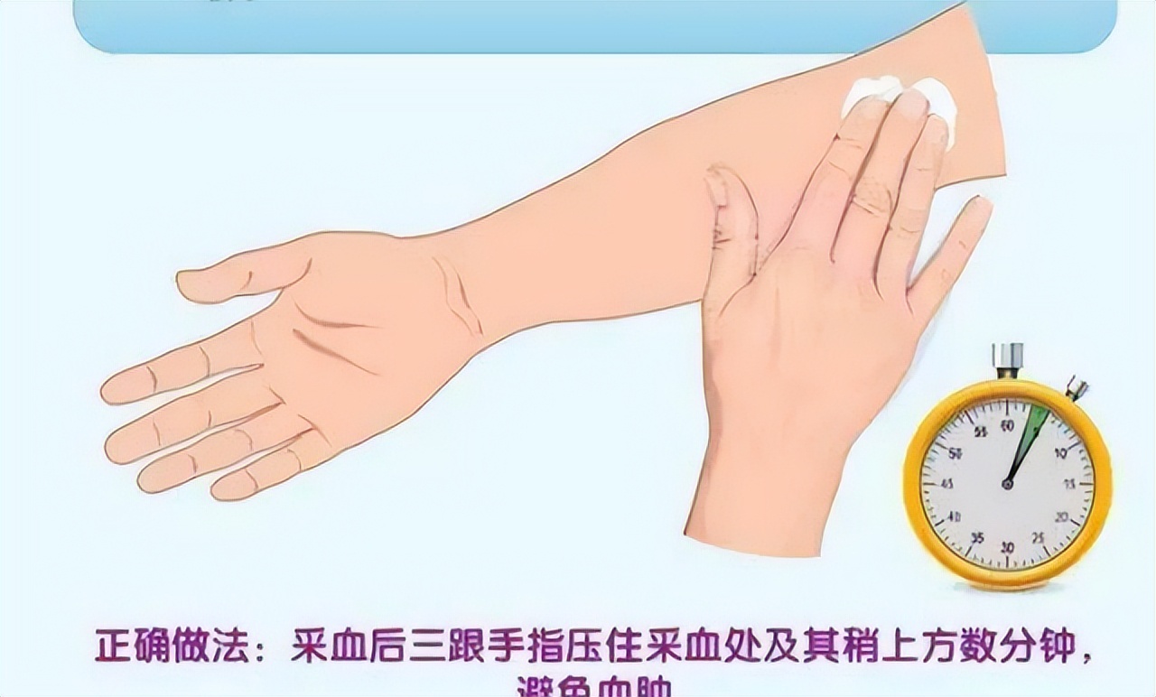 抽血完后手臂淤青又疼冷敷多久,孕妇抽血后手臂淤青怎么办