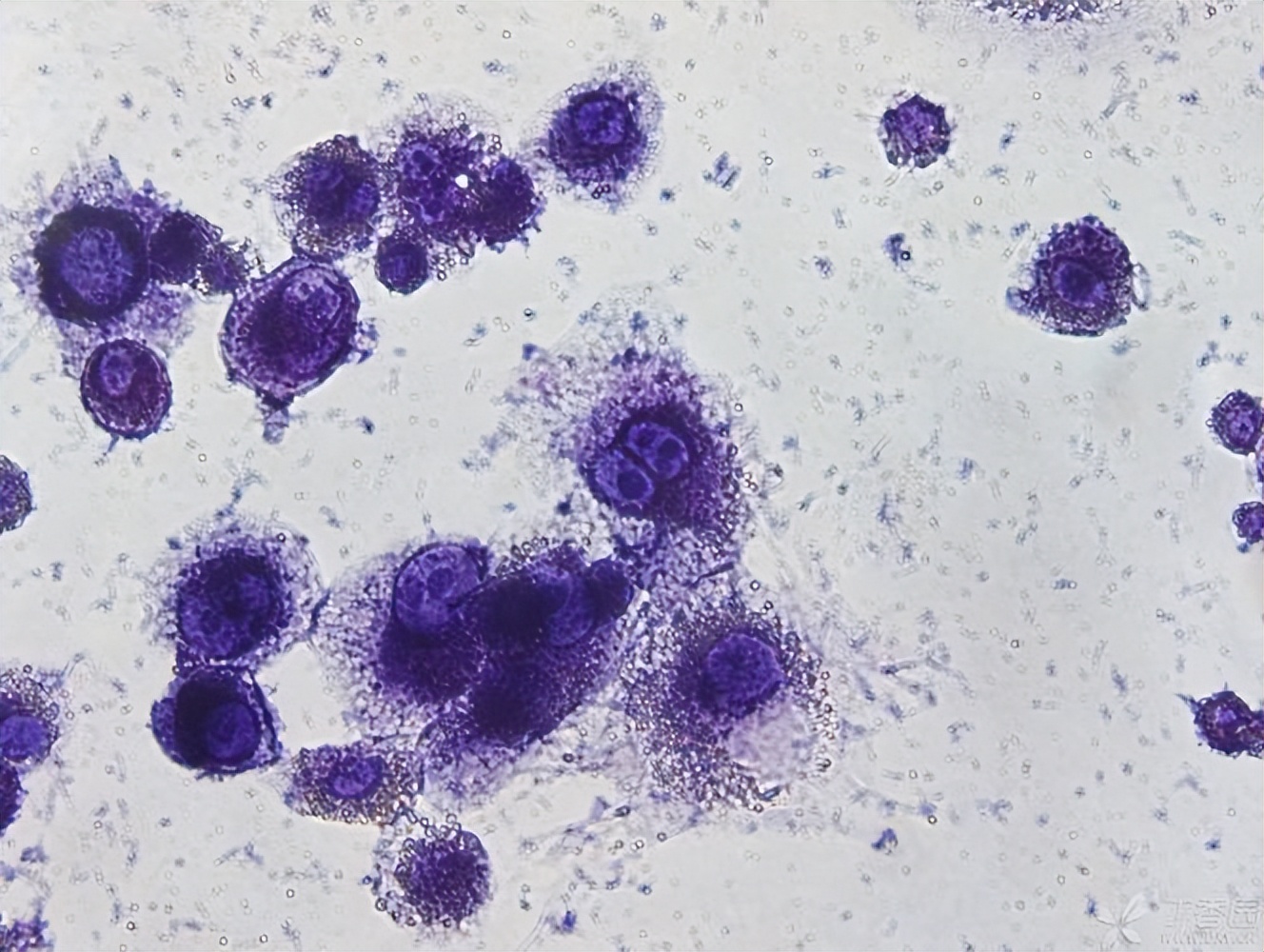 腰椎退行性变骨质疏松怎么办,骨质疏松腰椎症状