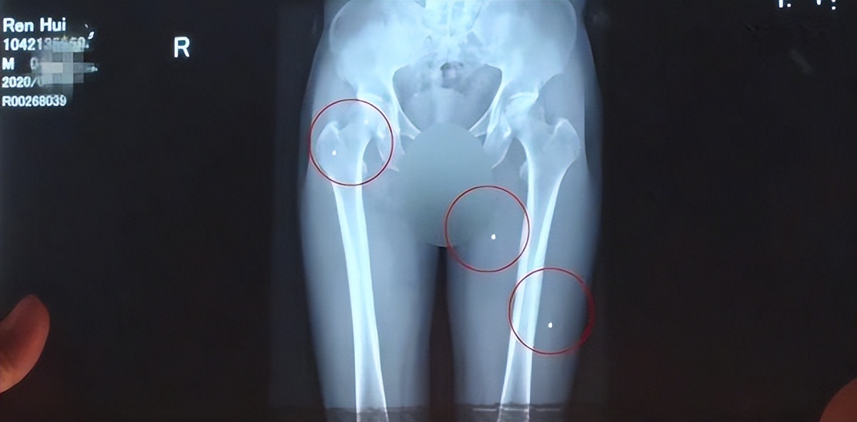 村民夜钓疑被当成野猪,江西夜钓被当野猪打