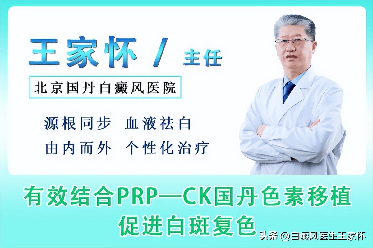 白斑怎么复色最快,白癜风复色后怎么控制不复发