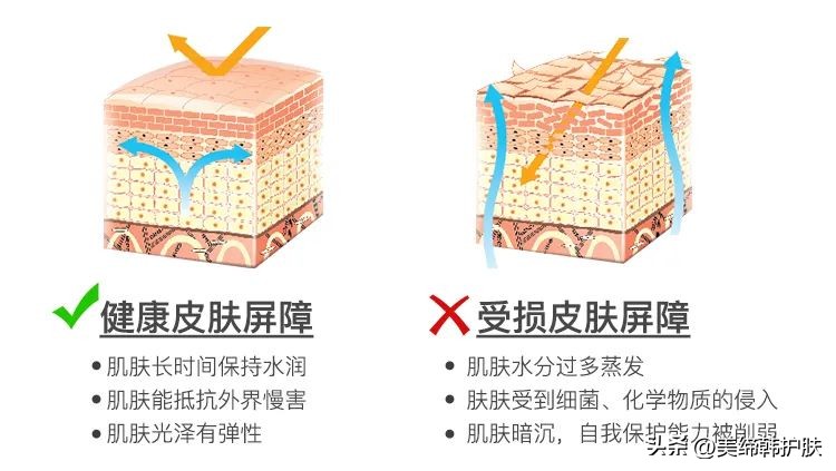 红血丝敏感肌夏天怎么护肤,敏感肌的正确护肤方法