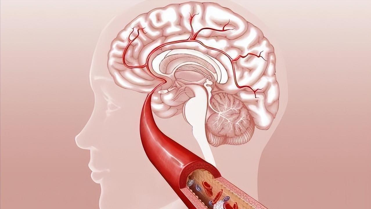 许多医生为什么不建议磁共振检查,磁共振检查有什么好处和坏处