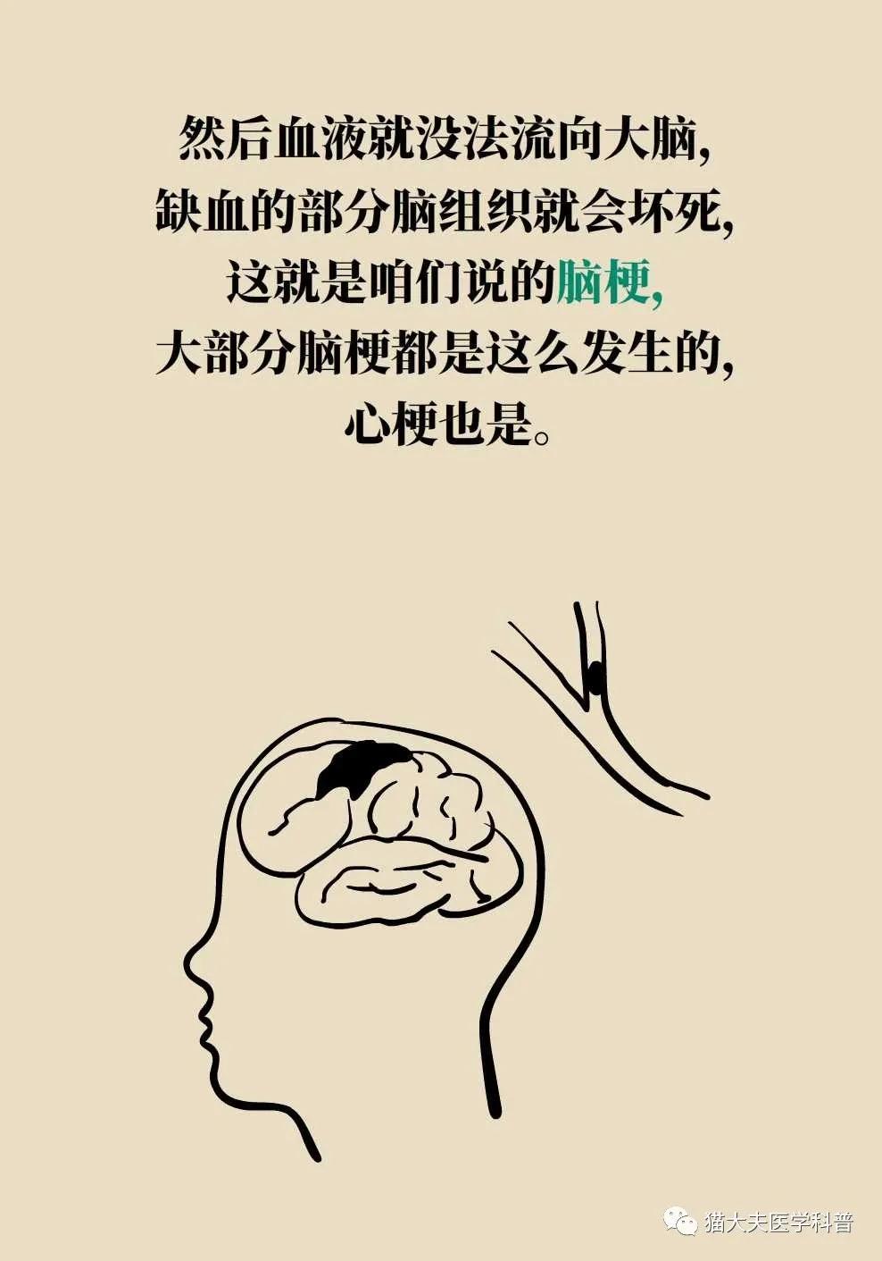 血管健康日为什么定在5月18日,血管的健康日