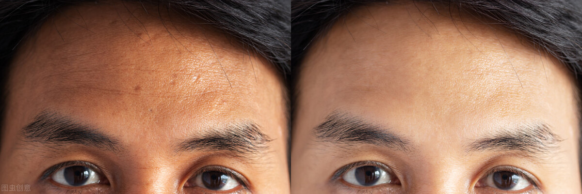 气血不足的十大症状表现怎么治疗,列举六个气血不足的症状表现