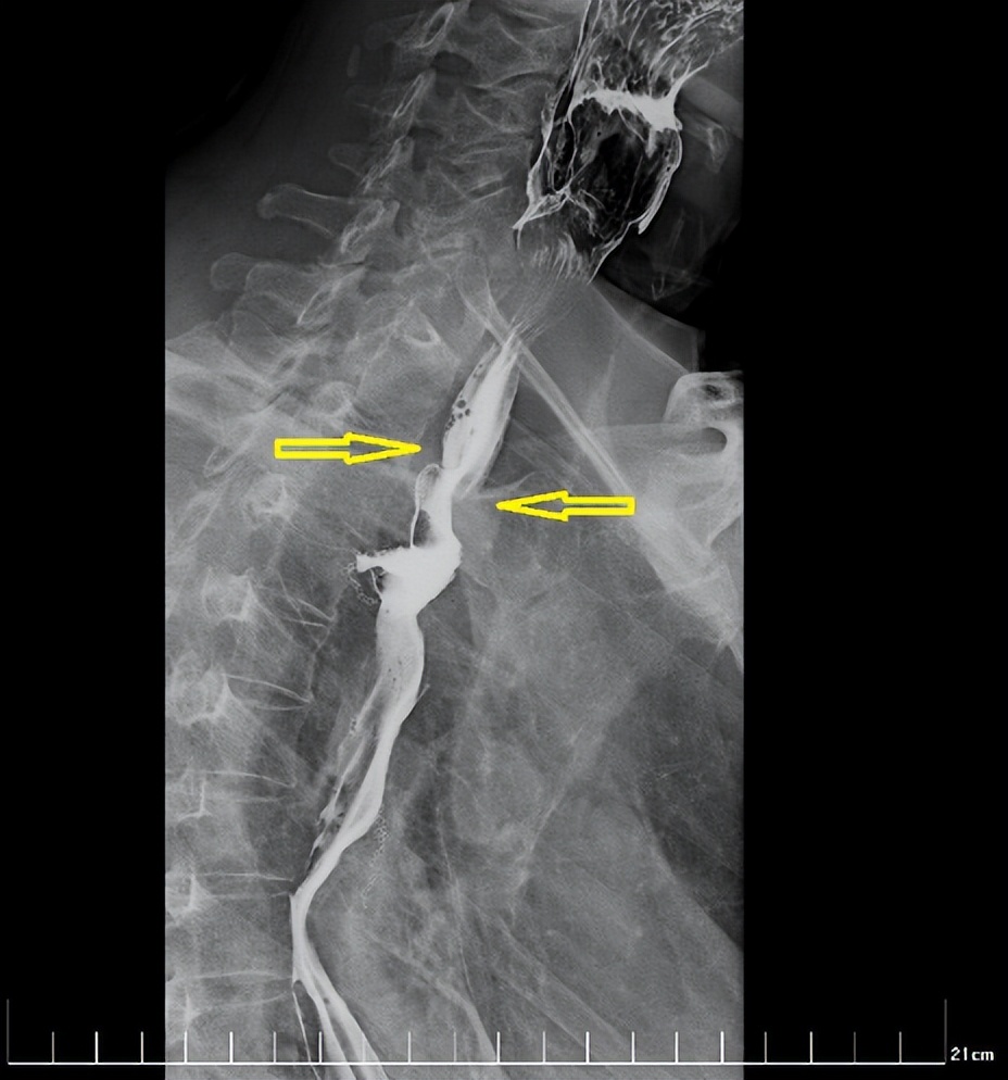 西安国际医学中心磁波刀,西安市国际医学中心肿瘤手术