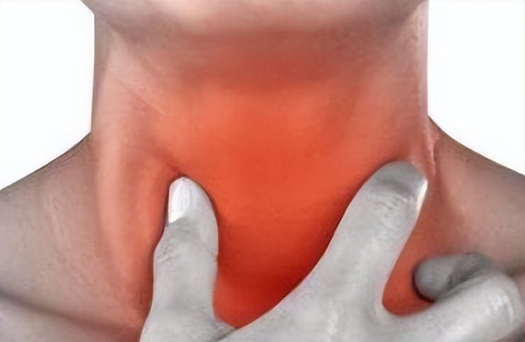 儿童急性扁桃体炎症状及治疗,急性扁桃体炎的主要并发症是什么