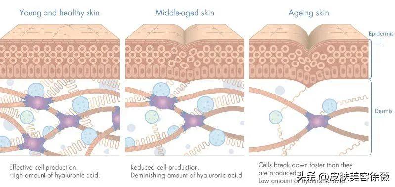 口服玻尿酸靠谱不,有钱人都在吃保健品