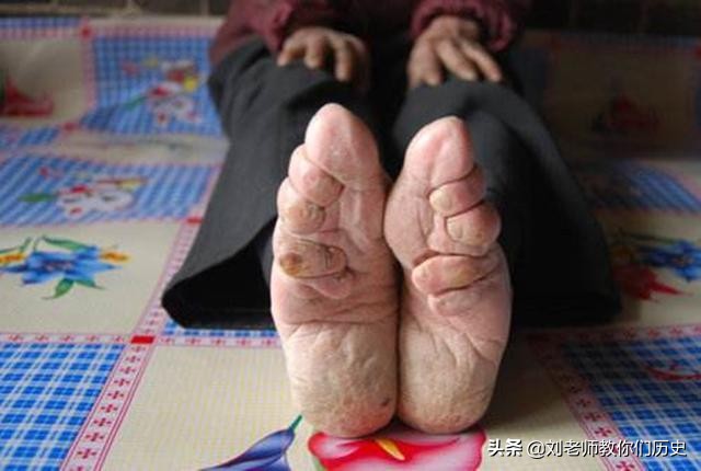 历史上什么朝代开始裹小脚,古代裹小脚的真实目的是什么
