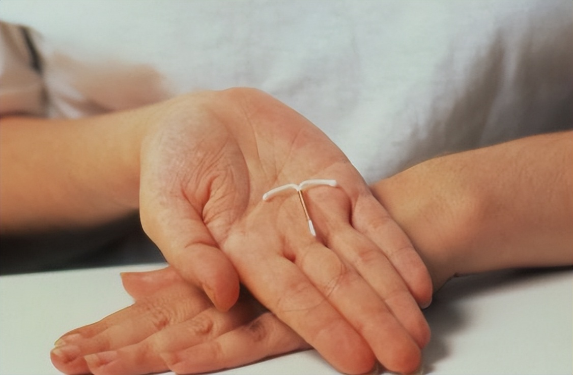 节育环在女性体内,会发生哪些变化?30年前上环的女性有哪些结局