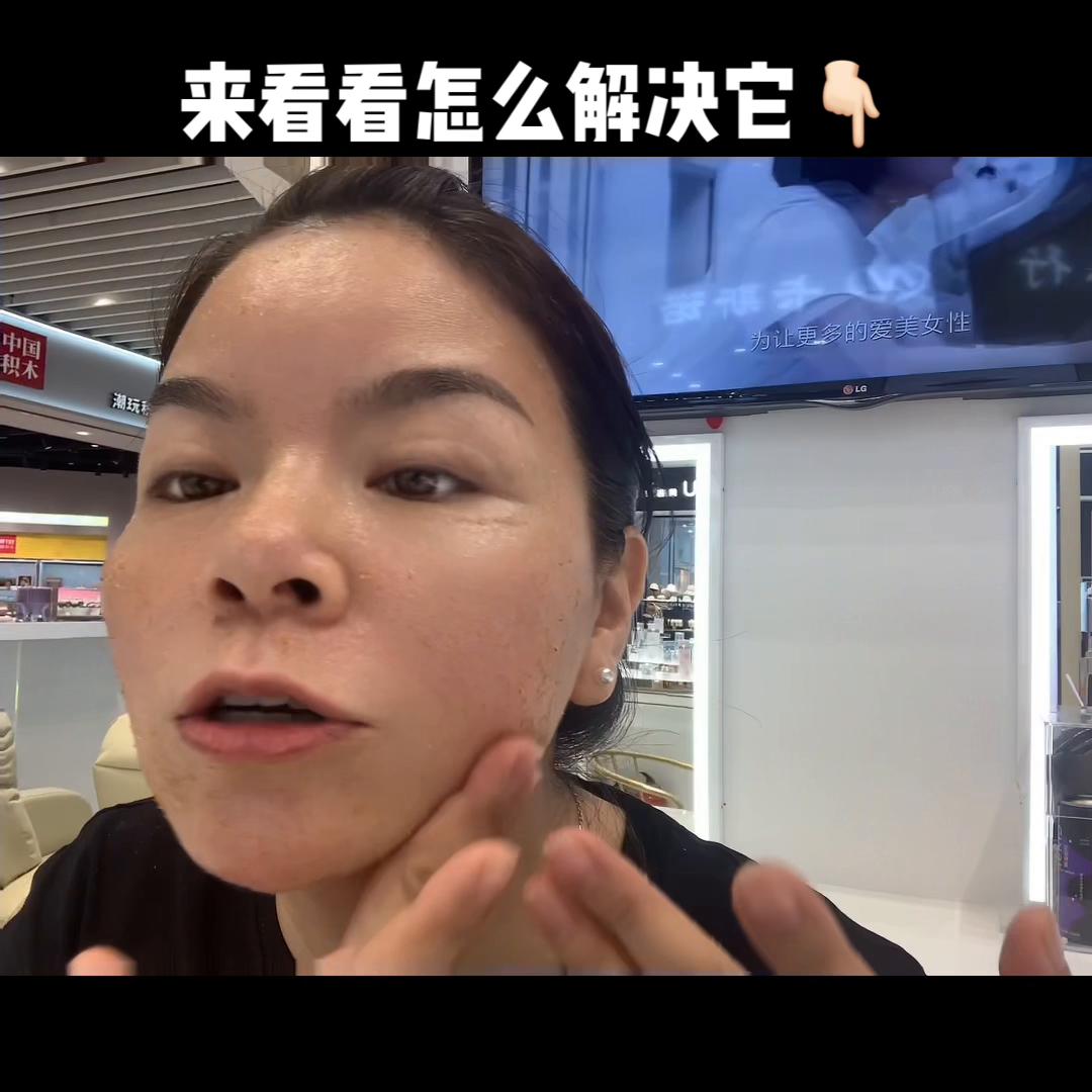 厚涂了霜在脸上不吸收,脸上涂什么都不吸收