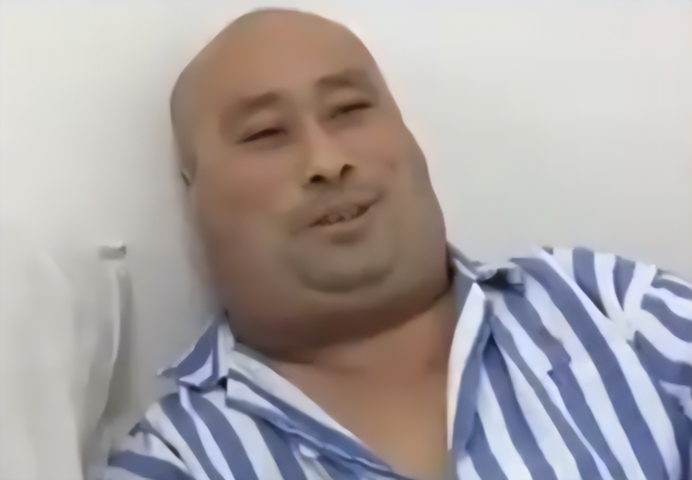 62岁大叔喝出河马脖,辽宁男子喝酒成河马