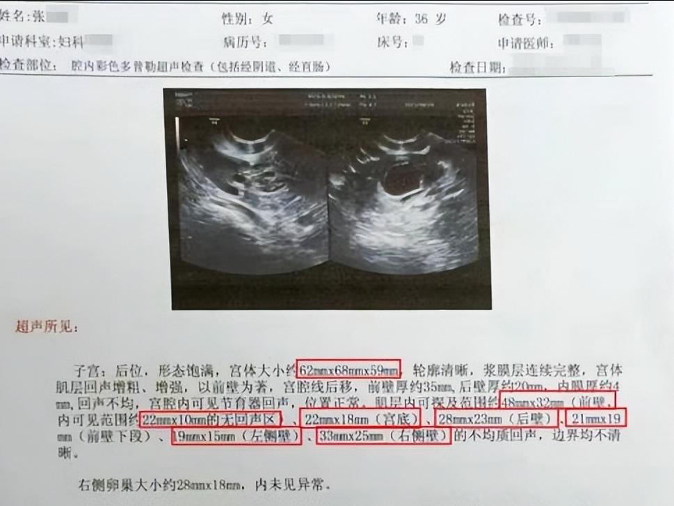 痛经从18岁到32岁了还痛经,门诊日记30篇