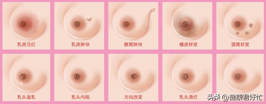 乳房胀痛是排卵吗,乳房胀痛会是乳腺癌吗