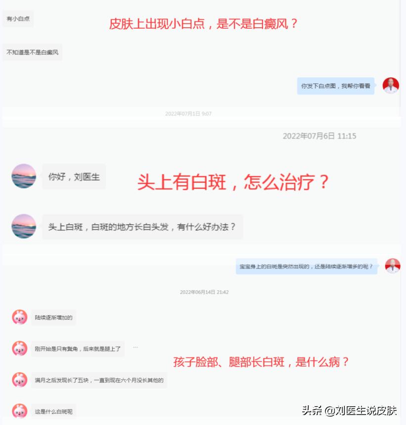 白癜风不扩散的白斑是白癜风吗,确诊白癜风出现白斑就是白癜风吗