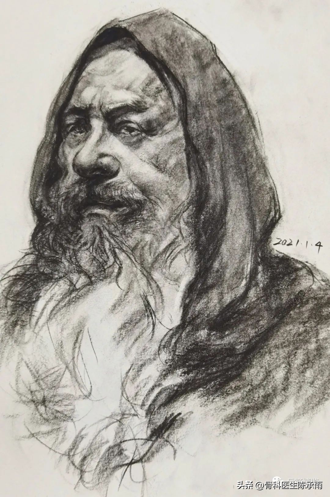 右肱骨外科颈骨折康复视频,肱骨颈骨折后并发症有哪些