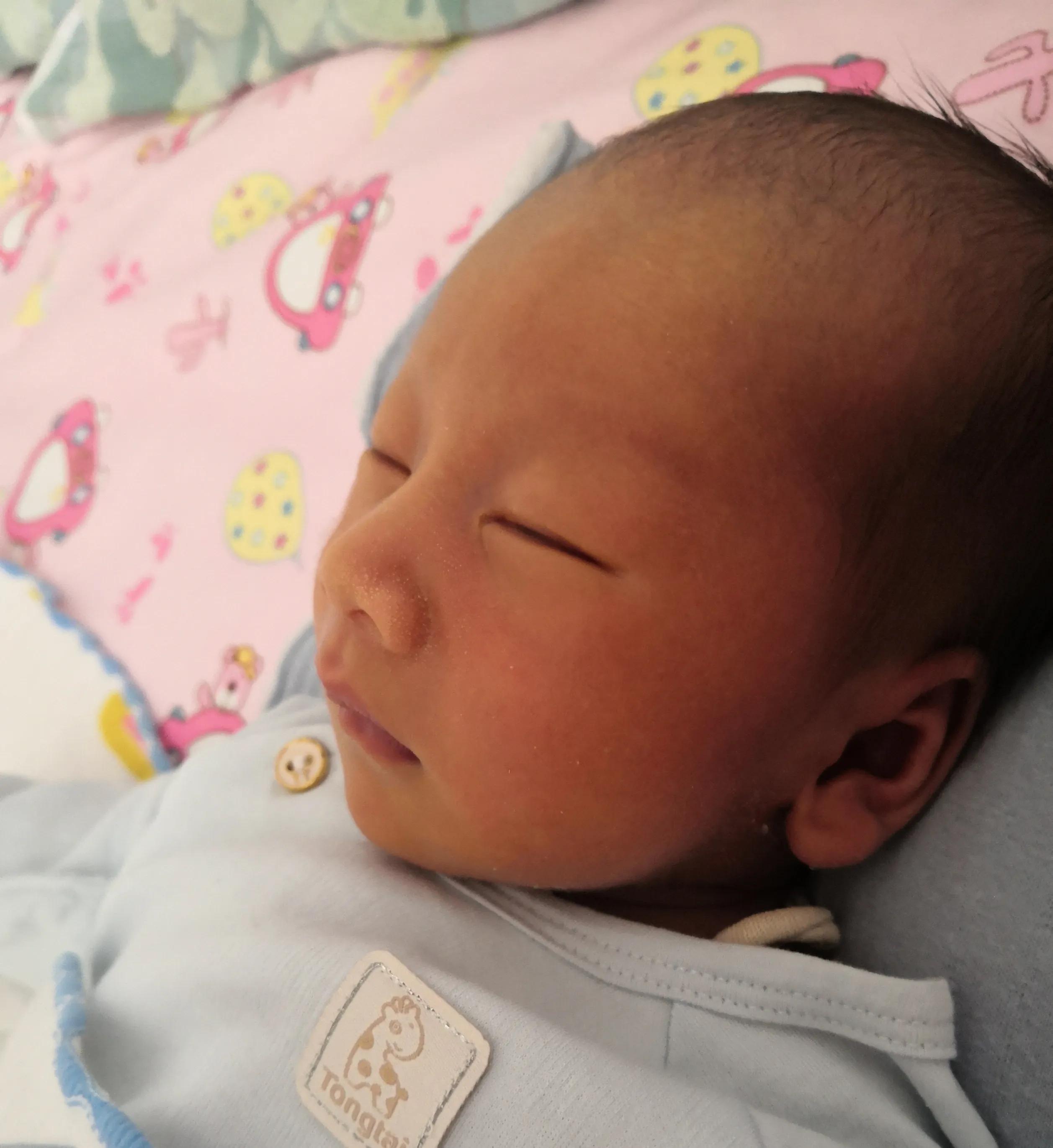 黄疸两个月还没退下去怎么办,母乳性黄疸两个月还没退