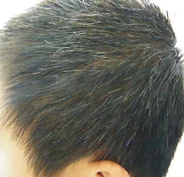 白发越拔越多是有根据的,白发真的会越拔越多嘛