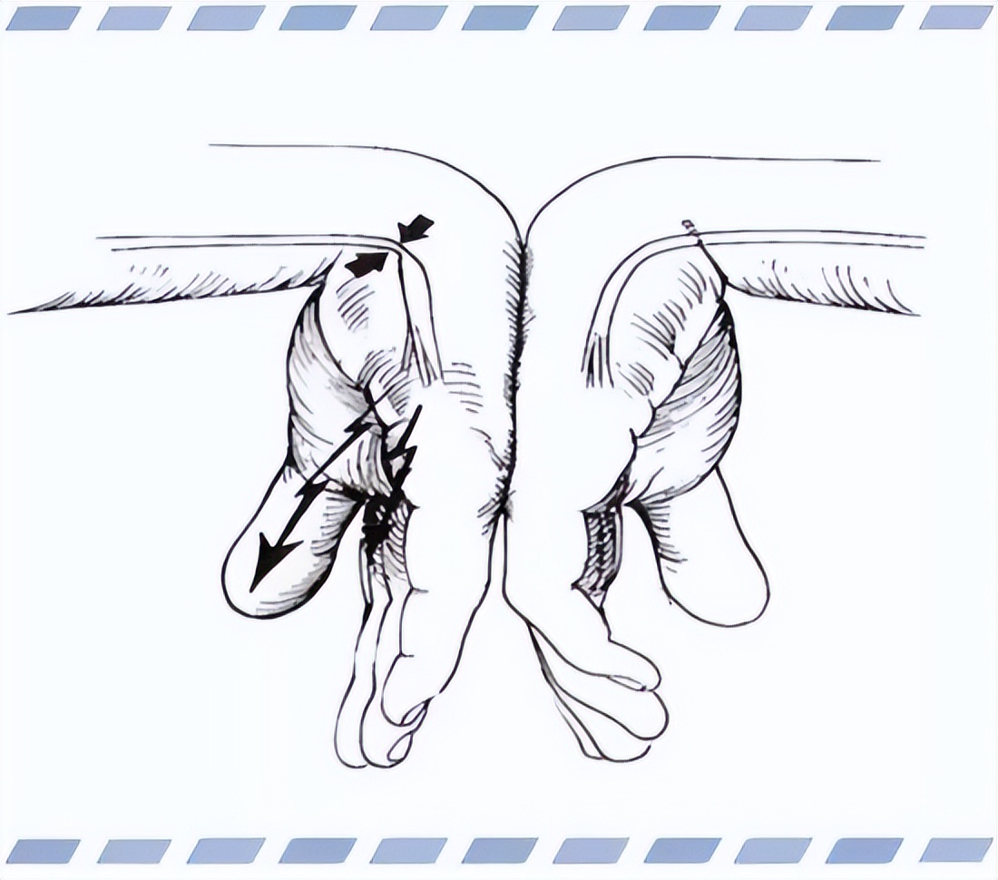 鼠标手手腕疼缓解方法,手握鼠标手麻了怎么办