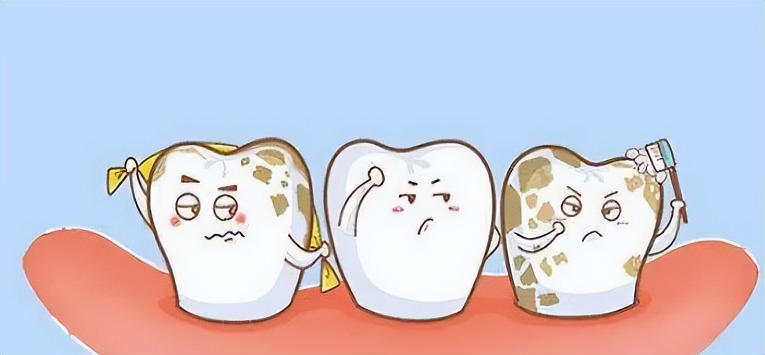 牙菌斑知多少,怎么去牙菌斑