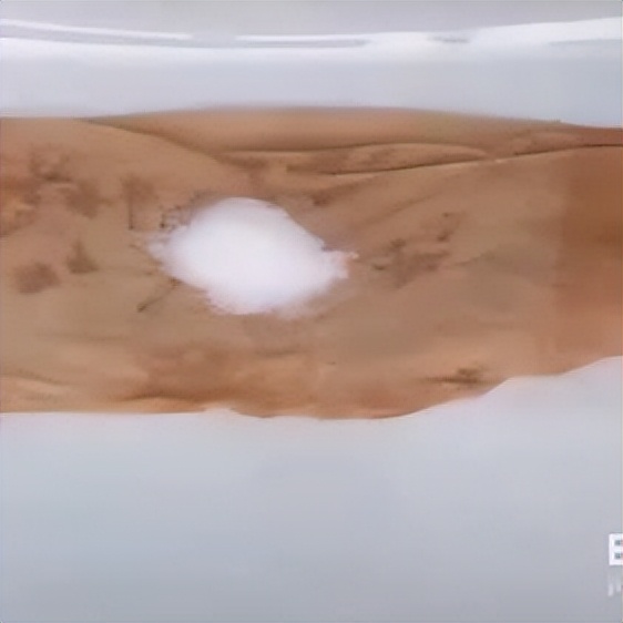 袜跟线老断是什么原因,弹力袜勾丝了怎么办