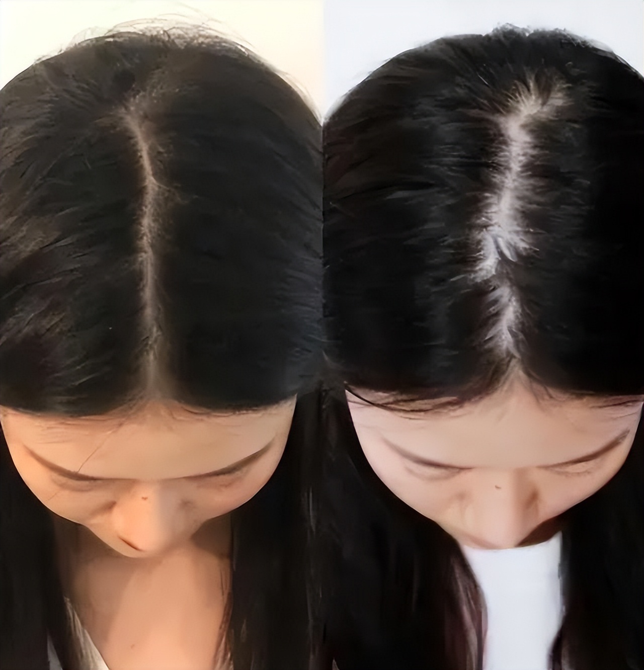 洗头皂止痒控油,洗头皂测评真实推荐排行榜第一名