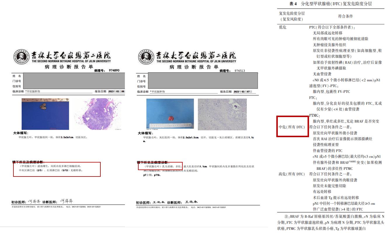 甲状腺术后需要忌碘吗,甲状腺术后忌碘
