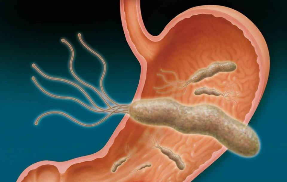 阿莫西林不能乱吃这五种病才有效,阿莫西林或许只对5种病有效