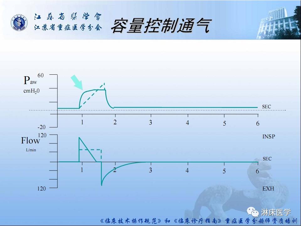 机械通气患者气道管理ppt,机械通气基础知识ppt